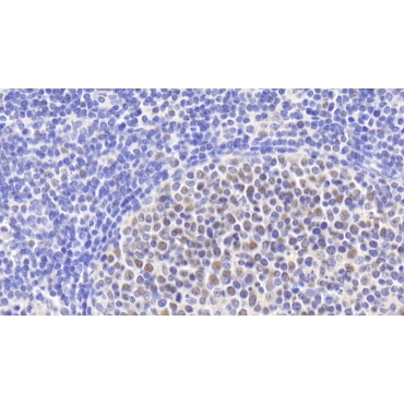 Minichromosome Maintenance Deficient 3 (MCM3) Human Polyclonal Antibody