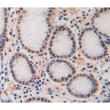 Cell Division Cycle Protein 7 (CDC7) Human Polyclonal Antibody