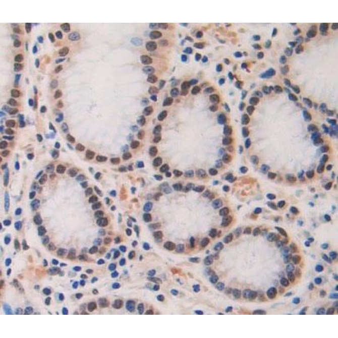 Cell Division Cycle Protein 7 (CDC7) Human Polyclonal Antibody