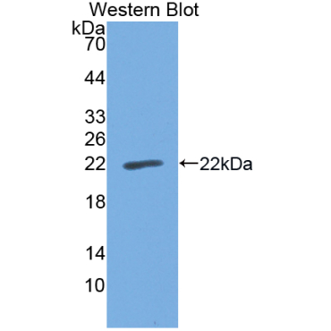 Cell Division Cycle Protein 25 (CDC25) Human Polyclonal Antibody