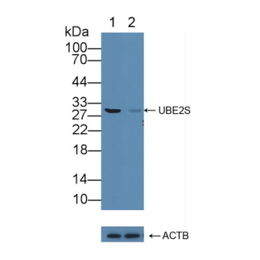 Ubiquitin Conjugating Enzyme E2S (UBE2S) Human Polyclonal Antibody