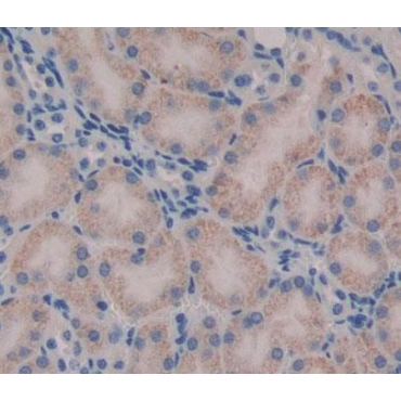 Tryptophanyl tRNA Synthetase 2, Mitochondrial (WARS2) Human Polyclonal Antibody