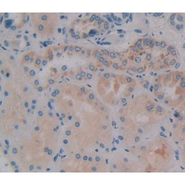 Dihydropyrimidinase Like Protein 4 (DPYSL4) Human Polyclonal Antibody