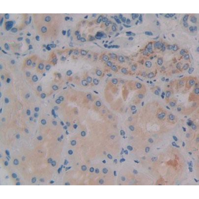 Dihydropyrimidinase Like Protein 4 (DPYSL4) Human Polyclonal Antibody