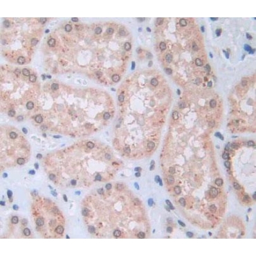 Collapsin Response Mediator Protein 5 (CRMP5) Human Polyclonal Antibody