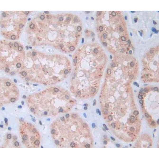 Collapsin Response Mediator Protein 5 (CRMP5) Human Polyclonal Antibody