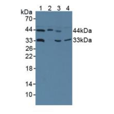 Hydroxymethylbilane Synthase (HMBS) Human Polyclonal Antibody