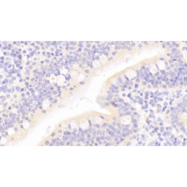 Regenerating Islet Derived Protein 3 Alpha (REG3a) Human Polyclonal Antibody