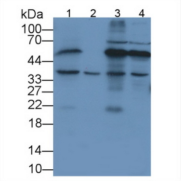 FK506 Binding Protein 8 (FKBP8) Human Polyclonal Antibody