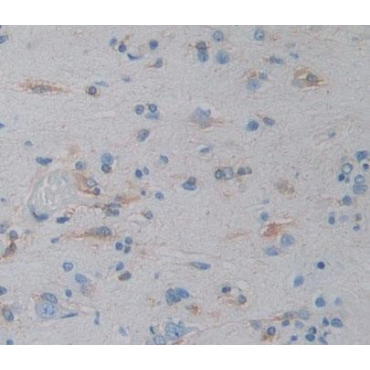 Selenoprotein N1 (SEPN1) Human Polyclonal Antibody