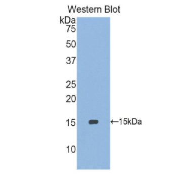 Selenoprotein X1 (SEPX1) Human Polyclonal Antibody