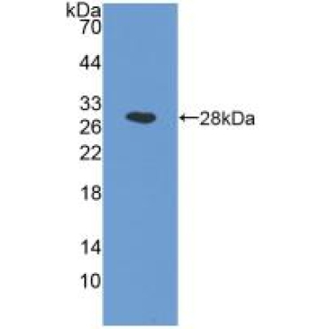 N-Acylethanolamine Acid Amidase (NAAA) Human Polyclonal Antibody