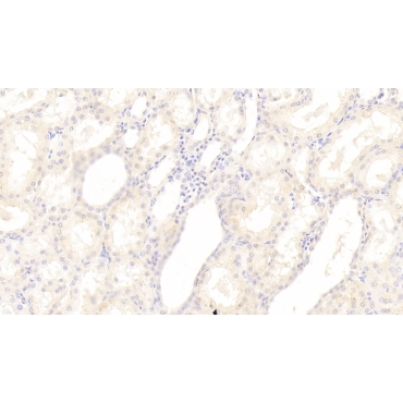Sphingosine 1 Phosphate Lyase 1 (SGPL1) Human Polyclonal Antibody