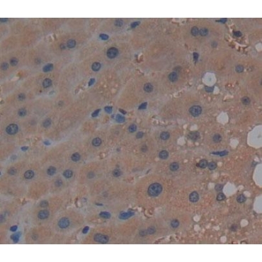 Sphingosine Kinase 2 (SPHK2) Human Polyclonal Antibody