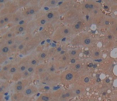 Sphingosine Kinase 2 (SPHK2) Human Polyclonal Antibody
