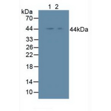 Inhibitory Subunit Of NF Kappa B Epsilon (IkBe) Human Polyclonal Antibody