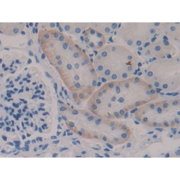 Inhibitory Subunit Of NF Kappa B Epsilon (IkBe) Mouse Polyclonal Antibody