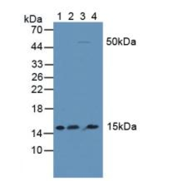 Inhibitory Subunit Of NF Kappa B Delta (IkBd) Human Polyclonal Antibody