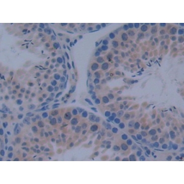 Inhibitory Subunit Of NF Kappa B Delta (IkBd) Mouse Polyclonal Antibody