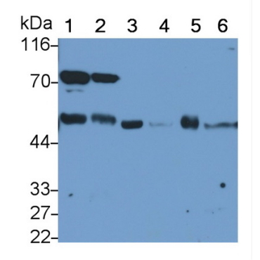 Tubulin Beta 3 (TUBb3) Human Polyclonal Antibody