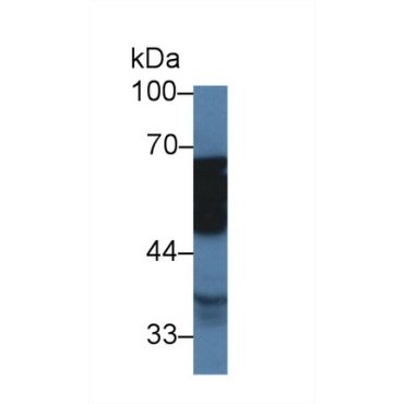 Tubulin Delta (TUBd) Human Polyclonal Antibody