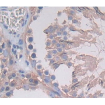 Tubulin Epsilon (TUBe) Human Polyclonal Antibody