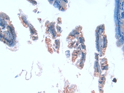 Tubulin Epsilon (TUBe) Mouse Polyclonal Antibody