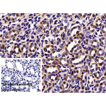 Karyopherin Beta (KPNb1) Human Polyclonal Antibody
