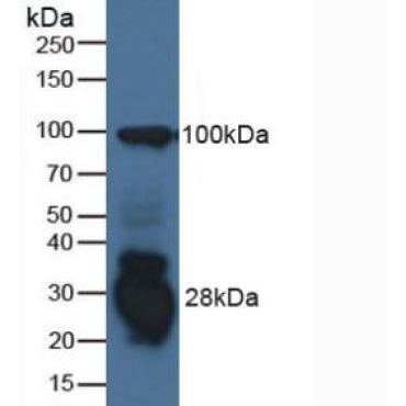 Interferon Gamma Inducible Protein 30 (IFI30) Human Polyclonal Antibody