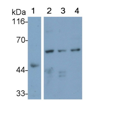 Interleukin 31 Receptor A (IL31RA) Human Polyclonal Antibody