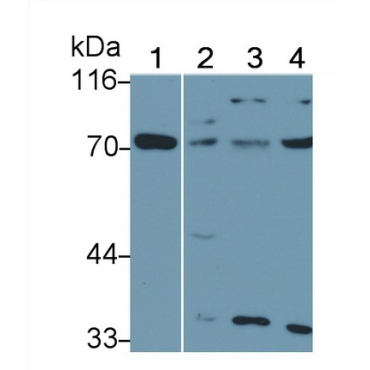 Interleukin 22 Receptor (IL22R) Human Polyclonal Antibody
