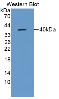 Interleukin 22 Receptor (IL22R) Mouse Polyclonal Antibody