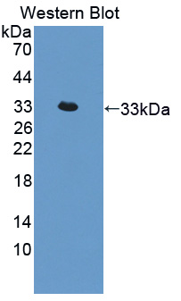 Interleukin 22 Receptor (IL22R) Rat Polyclonal Antibody