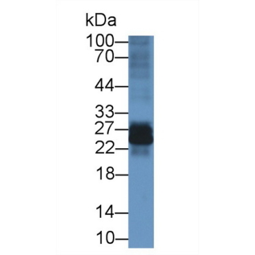 Interleukin 22 Receptor Alpha 2 (IL22Ra2) Mouse Polyclonal Antibody