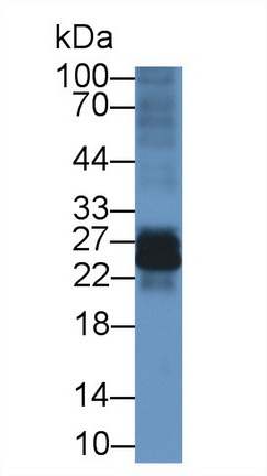 Interleukin 22 Receptor Alpha 2 (IL22Ra2) Mouse Polyclonal Antibody