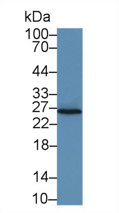 Interleukin 22 Receptor Alpha 2 (IL22Ra2) Rat Polyclonal Antibody