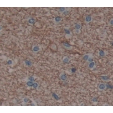 Interleukin 20 Receptor Alpha (IL20Ra) Human Polyclonal Antibody
