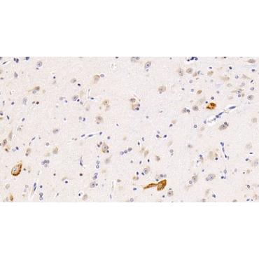 Interleukin 11 Receptor Alpha (IL11Ra) Human Polyclonal Antibody