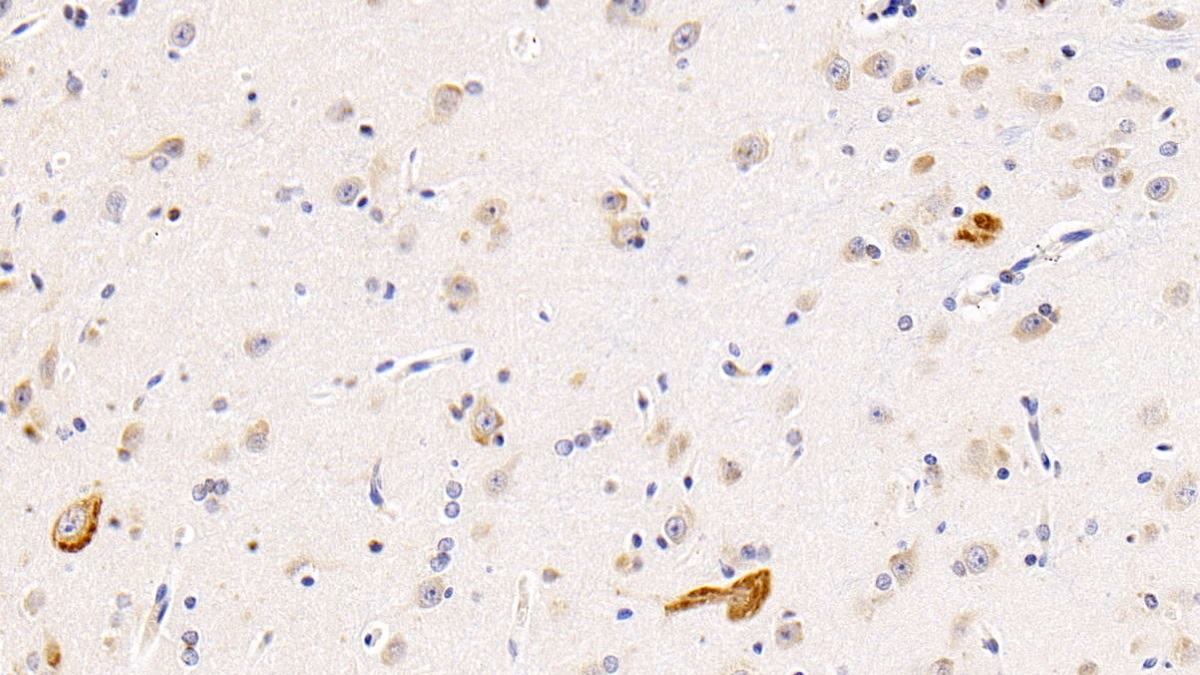 Interleukin 11 Receptor Alpha (IL11Ra) Human Polyclonal Antibody