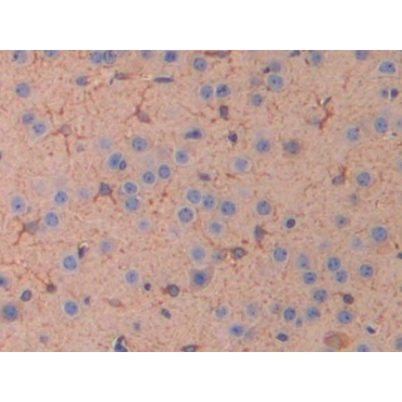 Interleukin 11 Receptor Alpha (IL11Ra) Mouse Polyclonal Antibody