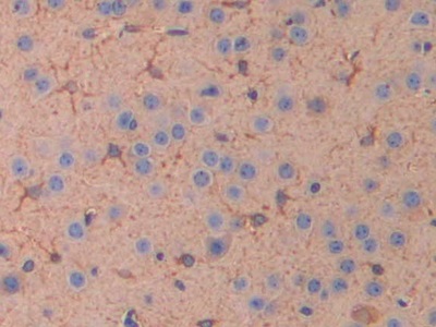 Interleukin 11 Receptor Alpha (IL11Ra) Mouse Polyclonal Antibody