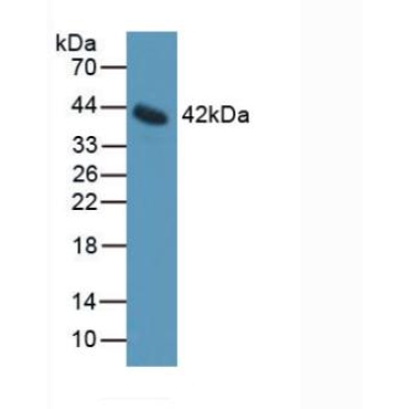 Interleukin 11 Receptor Alpha (IL11Ra) Mouse Polyclonal Antibody