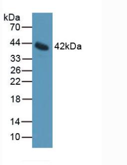 Interleukin 11 Receptor Alpha (IL11Ra) Mouse Polyclonal Antibody