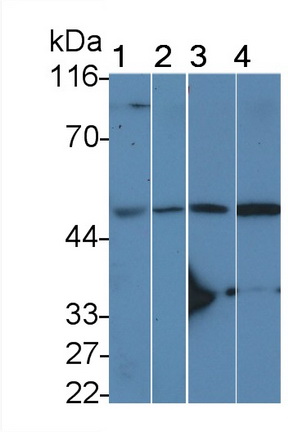 Interleukin 11 Receptor Alpha (IL11Ra) Rat Polyclonal Antibody