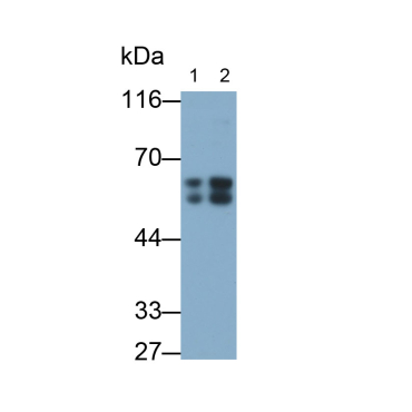 Immunoglobulin A1 (IgA1) Human Polyclonal Antibody