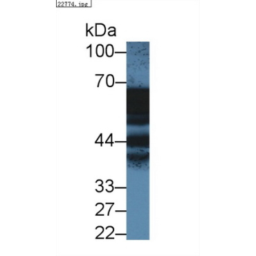 Annexin A11 (ANXA11) Human Polyclonal Antibody