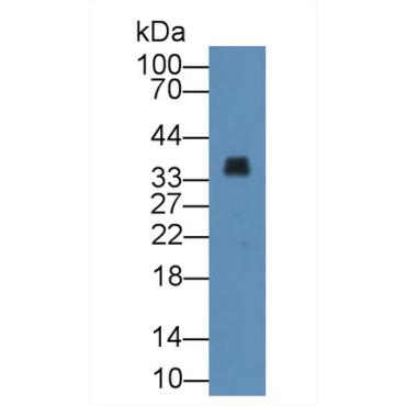 Annexin A3 (ANXA3) Human Polyclonal Antibody