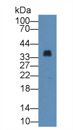 Annexin A3 (ANXA3) Human Polyclonal Antibody