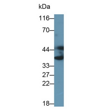 Annexin A3 (ANXA3) Human Polyclonal Antibody