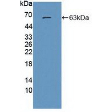 Glutamate Receptor, Ionotropic, N-Methyl-D-Aspartate 2A (GRIN2A) Human Polyclonal Antibody